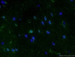 Aldolase C Rabbit anti-Human, Mouse, Rat, Polyclonal, Proteintech:Antibodies:Primary