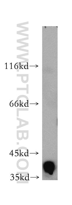 Aldolase C Rabbit anti-Human, Mouse, Rat, Polyclonal, Proteintech:Antibodies:Primary