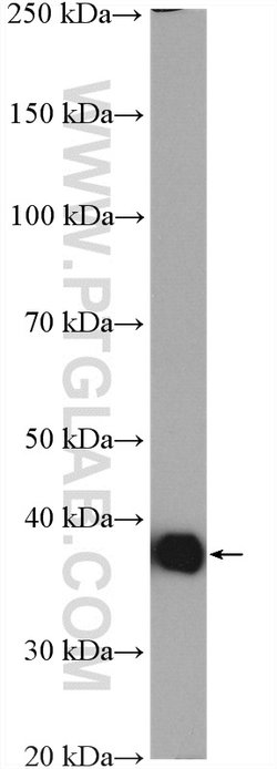 Aldolase C Rabbit anti-Human, Mouse, Rat, Polyclonal, Proteintech:Antibodies:Primary