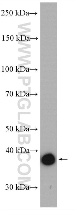 Aldolase C Rabbit anti-Human, Mouse, Rat, Polyclonal, Proteintech:Antibodies:Primary