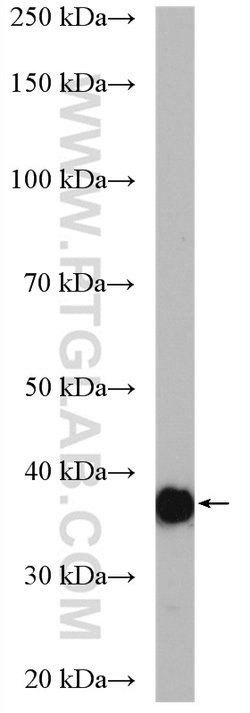 Aldolase C Rabbit anti-Human, Mouse, Rat, Polyclonal, Proteintech:Antibodies:Primary