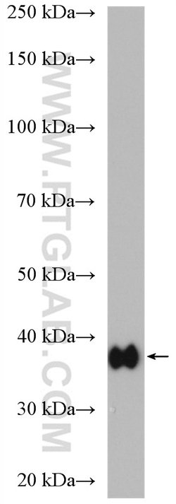 Aldolase C Rabbit anti-Human, Mouse, Rat, Polyclonal, Proteintech:Antibodies:Primary