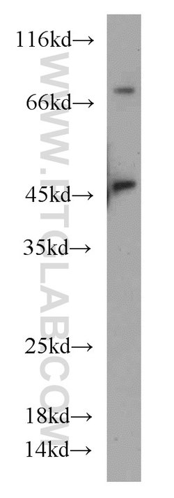 GOT1 Rabbit anti-Human, Mouse, Rat, Polyclonal, Proteintech 150 &mu;L;