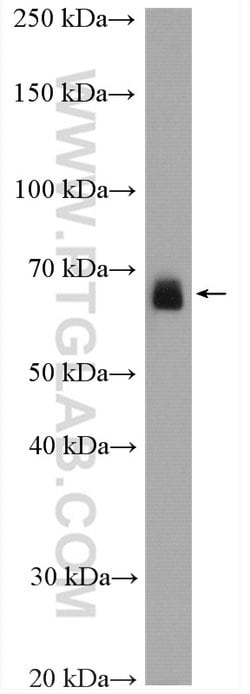 PCK2 Rabbit anti-Human, Mouse, Rat, Polyclonal, Proteintech 150 μL;