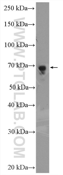 PCK2 Rabbit anti-Human, Mouse, Rat, Polyclonal, Proteintech 150 μL;