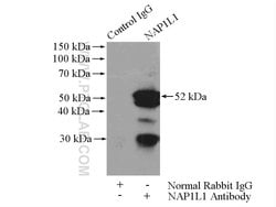 NAP1L1 Rabbit anti-Human, Mouse, Rat, Polyclonal, Proteintech 150 &mu;L;