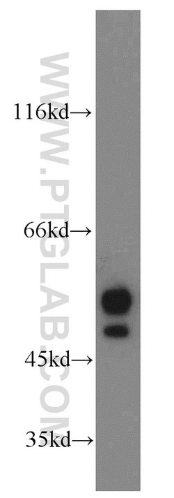 NAP1L1 Rabbit anti-Human, Mouse, Rat, Polyclonal, Proteintech 150 &mu;L;
