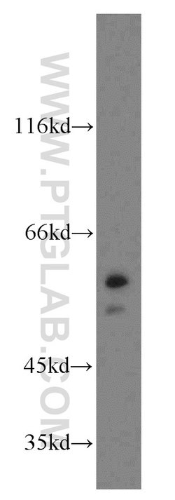 NAP1L1 Rabbit anti-Human, Mouse, Rat, Polyclonal, Proteintech 150 &mu;L;