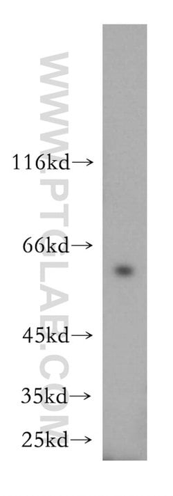 NAP1L1 Rabbit anti-Human, Mouse, Rat, Polyclonal, Proteintech 150 &mu;L;
