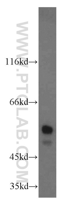 NAP1L1 Rabbit anti-Human, Mouse, Rat, Polyclonal, Proteintech 150 &mu;L;