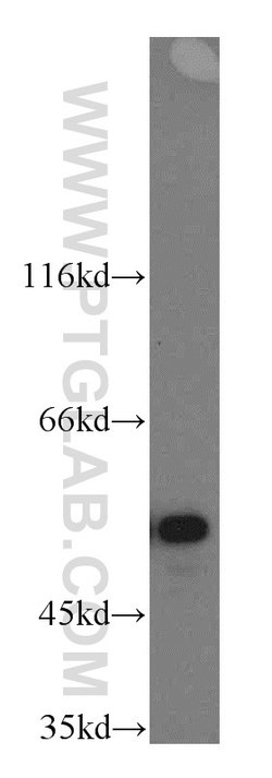 NAP1L1 Rabbit anti-Human, Mouse, Rat, Polyclonal, Proteintech 150 &mu;L;