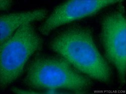 PSMD4 Rabbit anti-Human, Mouse, Rat, Polyclonal, Proteintech:Anticorps:Anticorps