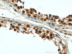 PSMD4 Rabbit anti-Human, Mouse, Rat, Polyclonal, Proteintech:Anticorps:Anticorps