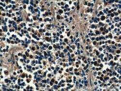 PSMD4 Rabbit anti-Human, Mouse, Rat, Polyclonal, Proteintech:Anticorps:Anticorps