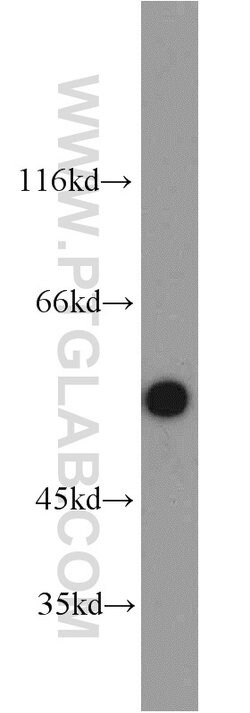 PSMD4 Rabbit anti-Human, Mouse, Rat, Polyclonal, Proteintech:Anticorps:Anticorps