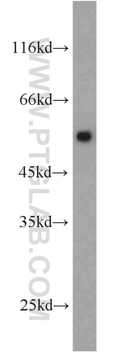 PSMD4 Rabbit anti-Human, Mouse, Rat, Polyclonal, Proteintech:Anticorps:Anticorps