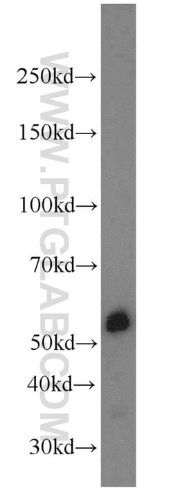PSMD4 Rabbit anti-Human, Mouse, Rat, Polyclonal, Proteintech:Anticorps:Anticorps
