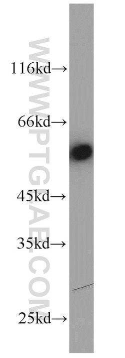 PSMD4 Rabbit anti-Human, Mouse, Rat, Polyclonal, Proteintech