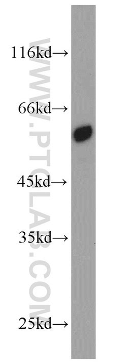 PSMD4 Rabbit anti-Human, Mouse, Rat, Polyclonal, Proteintech:Anticorps:Anticorps