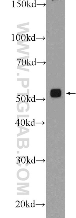 PSMD4 Rabbit anti-Human, Mouse, Rat, Polyclonal, Proteintech:Anticorps:Anticorps