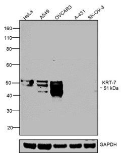 Invitrogen Cytokeratin 7 Monoclonal Antibody (LP5K), eBioscience , Invitrogen 25 &mu;g | Buy Online | Invitrogen&trade; | Fisher Scientific