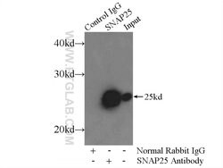 SNAP25 Rabbit anti-Human, Mouse, Rat, Polyclonal, Proteintech 20 &mu;L;