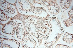 PSME3 Rabbit anti-Human, Mouse, Rat, Polyclonal, Proteintech 150 &mu;L;