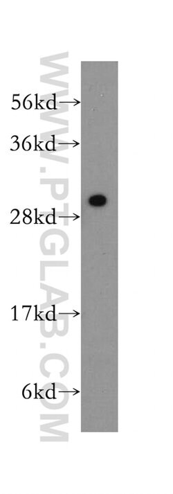 PSME3 Rabbit anti-Human, Mouse, Rat, Polyclonal, Proteintech 150 &mu;L;