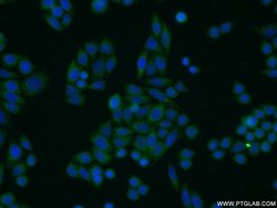 TOB1 Rabbit anti-Human, Mouse, Rat, Polyclonal, Proteintech:Antibodies:Primary