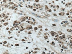 TOB1 Rabbit anti-Human, Mouse, Rat, Polyclonal, Proteintech:Antibodies:Primary