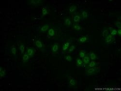 MEPCE Rabbit anti-Human, Mouse, Rat, Polyclonal, Proteintech:Antibodies:Primary