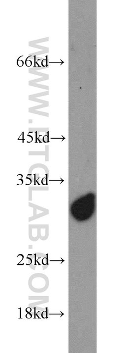 SCGN Rabbit anti-Human, Mouse, Rat, Polyclonal, Proteintech 150 μL;
