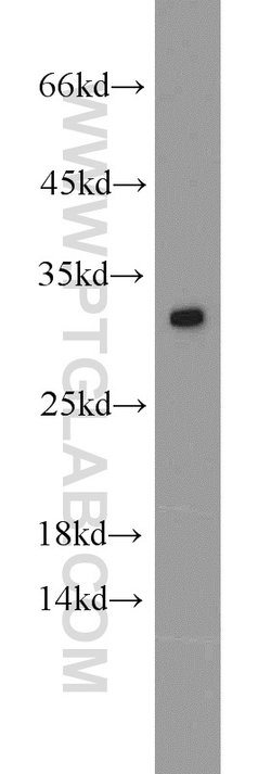 SCGN Rabbit anti-Human, Mouse, Rat, Polyclonal, Proteintech 150 μL;