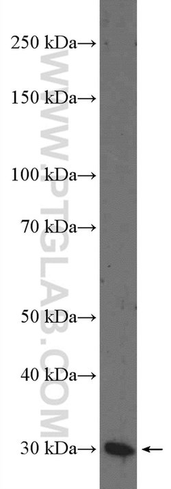 SCGN Rabbit anti-Human, Mouse, Rat, Polyclonal, Proteintech 150 μL;