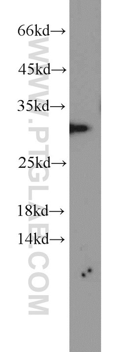 SCGN Rabbit anti-Human, Mouse, Rat, Polyclonal, Proteintech 150 μL;