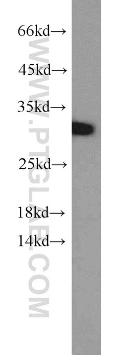 SCGN Rabbit anti-Human, Mouse, Rat, Polyclonal, Proteintech 150 μL;