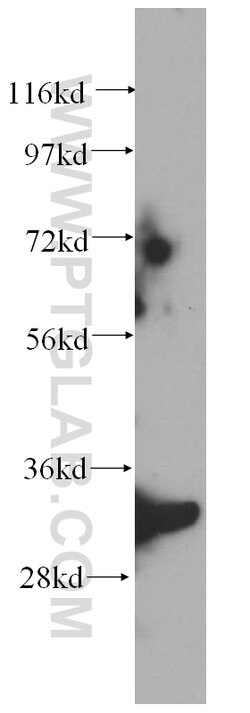 SCGN Rabbit anti-Human, Mouse, Rat, Polyclonal, Proteintech 150 μL;