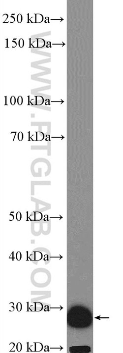 SCGN Rabbit anti-Human, Mouse, Rat, Polyclonal, Proteintech 150 μL;