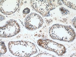 CNDP2 Rabbit anti-Human, Mouse, Rat, Polyclonal, Proteintech:Antibodies:Primary
