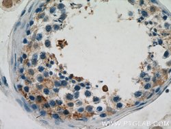 CNDP2 Rabbit anti-Human, Mouse, Rat, Polyclonal, Proteintech:Antibodies:Primary
