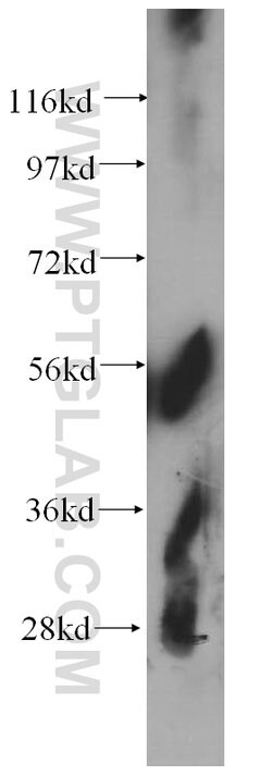 CNDP2 Rabbit anti-Human, Mouse, Rat, Polyclonal, Proteintech:Antibodies:Primary