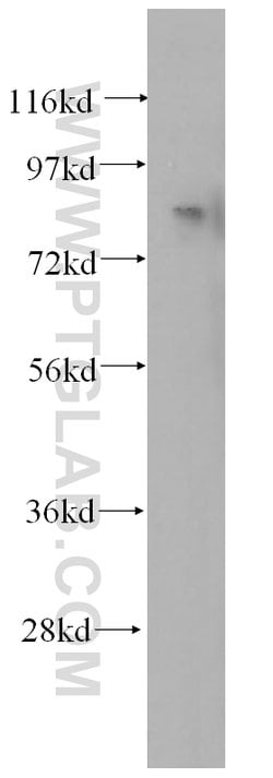 ANAPC5 Rabbit anti-Human, Mouse, Rat, Polyclonal, Proteintech:Antibodies:Primary