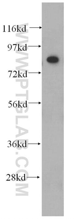 ANAPC5 Rabbit anti-Human, Mouse, Rat, Polyclonal, Proteintech:Antibodies:Primary