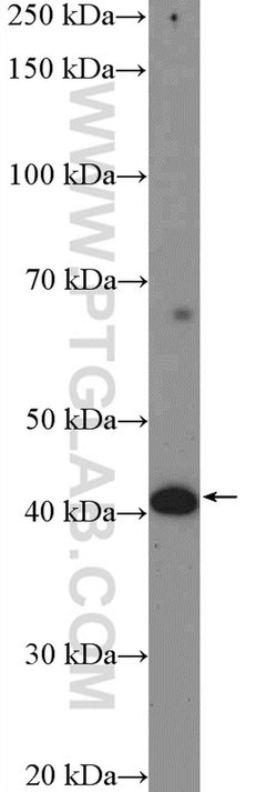 GCDH Rabbit anti-Human, Mouse, Rat, Polyclonal, Proteintech 20 &mu;L; Unconjugated:Antibodies,