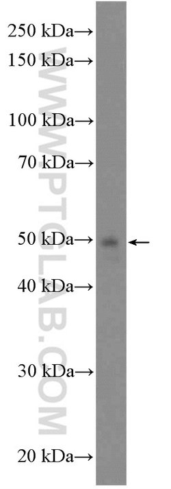 GCDH Rabbit anti-Human, Mouse, Rat, Polyclonal, Proteintech 20 &mu;L; Unconjugated:Antibodies,