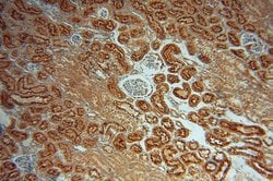 GALNS Rabbit anti-Human, Mouse, Rat, Polyclonal, Proteintech:Antibodies:Primary