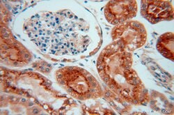 GALNS Rabbit anti-Human, Mouse, Rat, Polyclonal, Proteintech:Antibodies:Primary