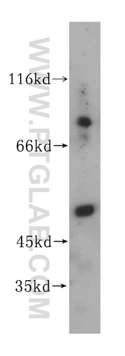 GALNS Rabbit anti-Human, Mouse, Rat, Polyclonal, Proteintech:Antibodies:Primary