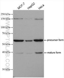 GALNS Rabbit anti-Human, Mouse, Rat, Polyclonal, Proteintech:Antibodies:Primary