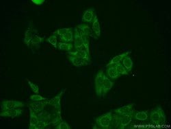 ZAK Rabbit anti-Human, Mouse, Rat, Polyclonal, Proteintech 20 &mu;L; Unconjugated:Antibodies,
